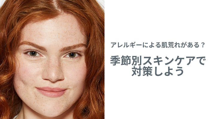 アレルギーによる肌荒れがある!?季節別スキンケアで対策しよう