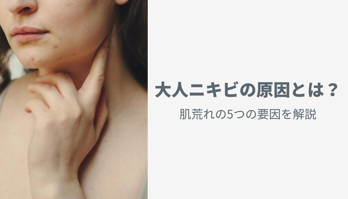 大人ニキビの原因とは?肌荒れの5つの要因を解説