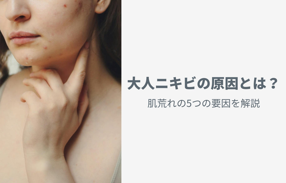 大人ニキビの原因とは？肌荒れの5つの要因を解説