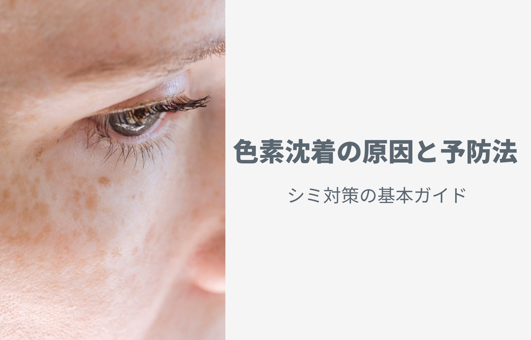 色素沈着の原因と予防法 — シミ対策の完全ガイド